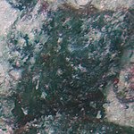 Black Fungus Disease (BFD)